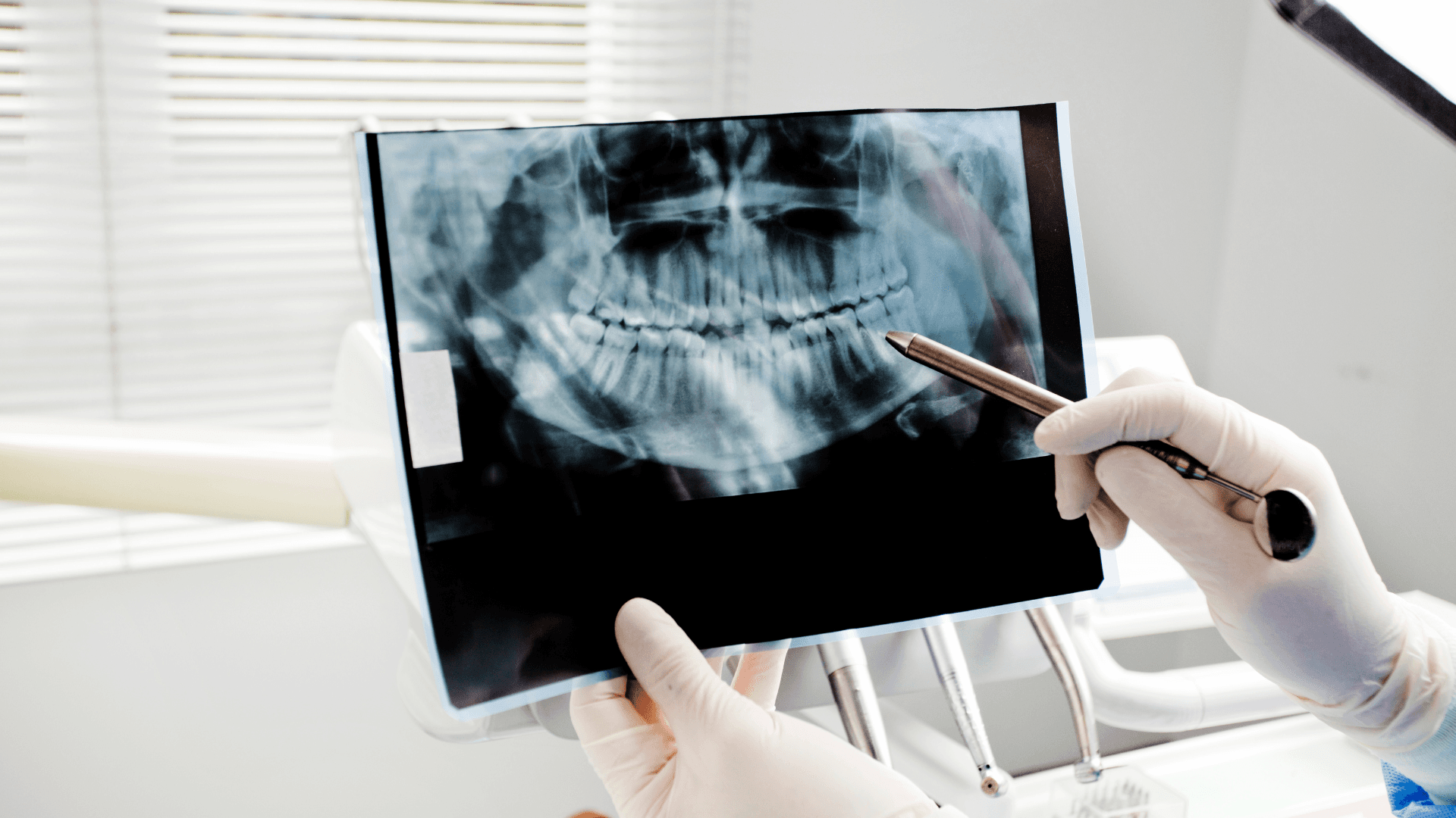 Dental X-Ray