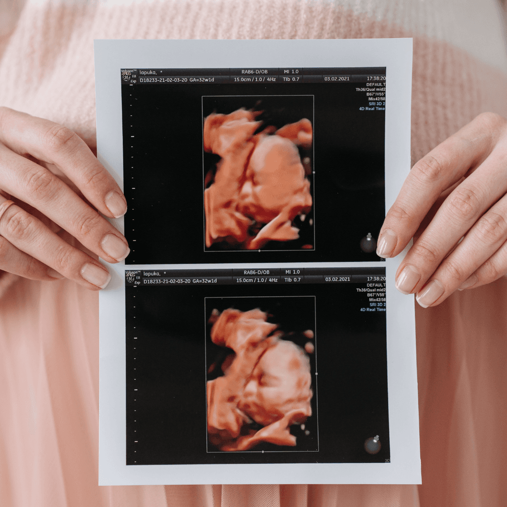 Ultrasound Banner