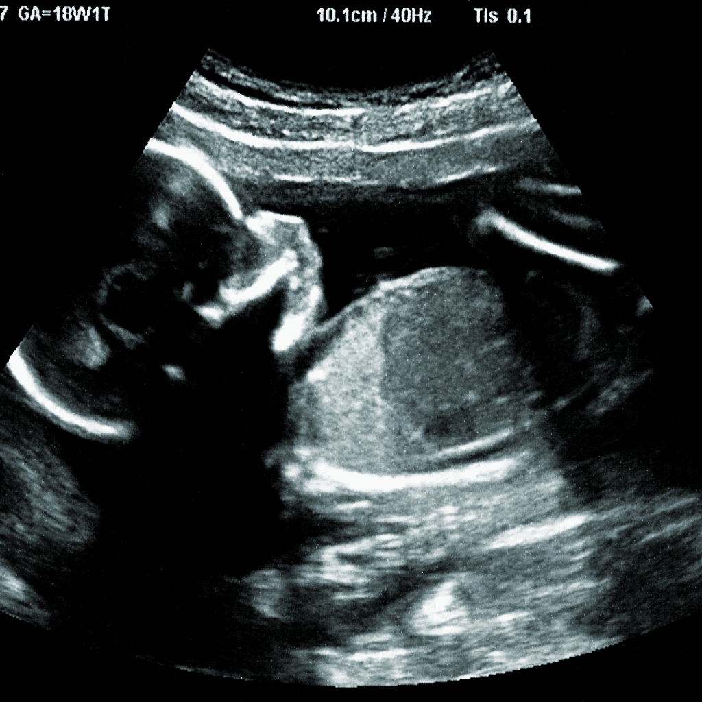 Ultrasound Banner
