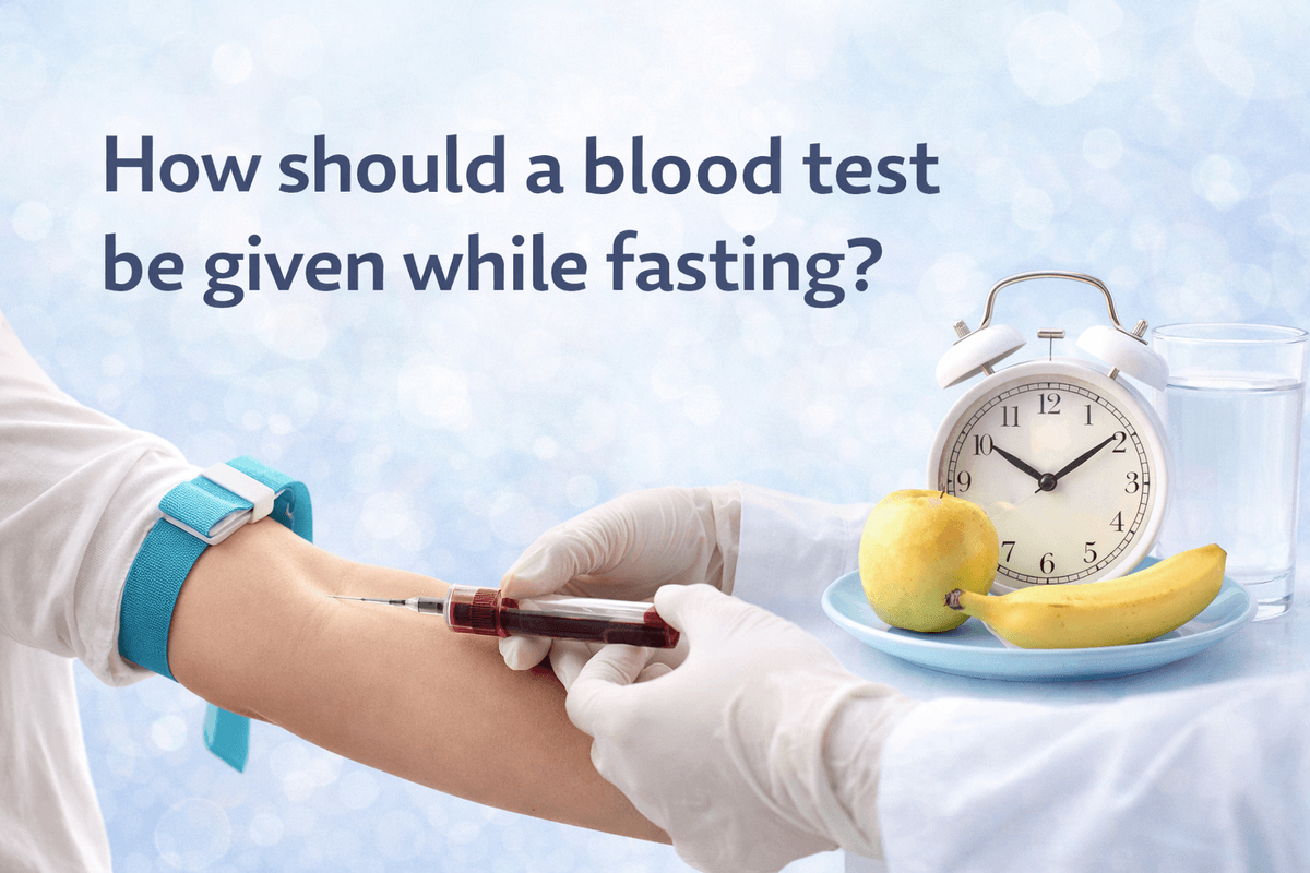 How should a blood test be given while fasting?