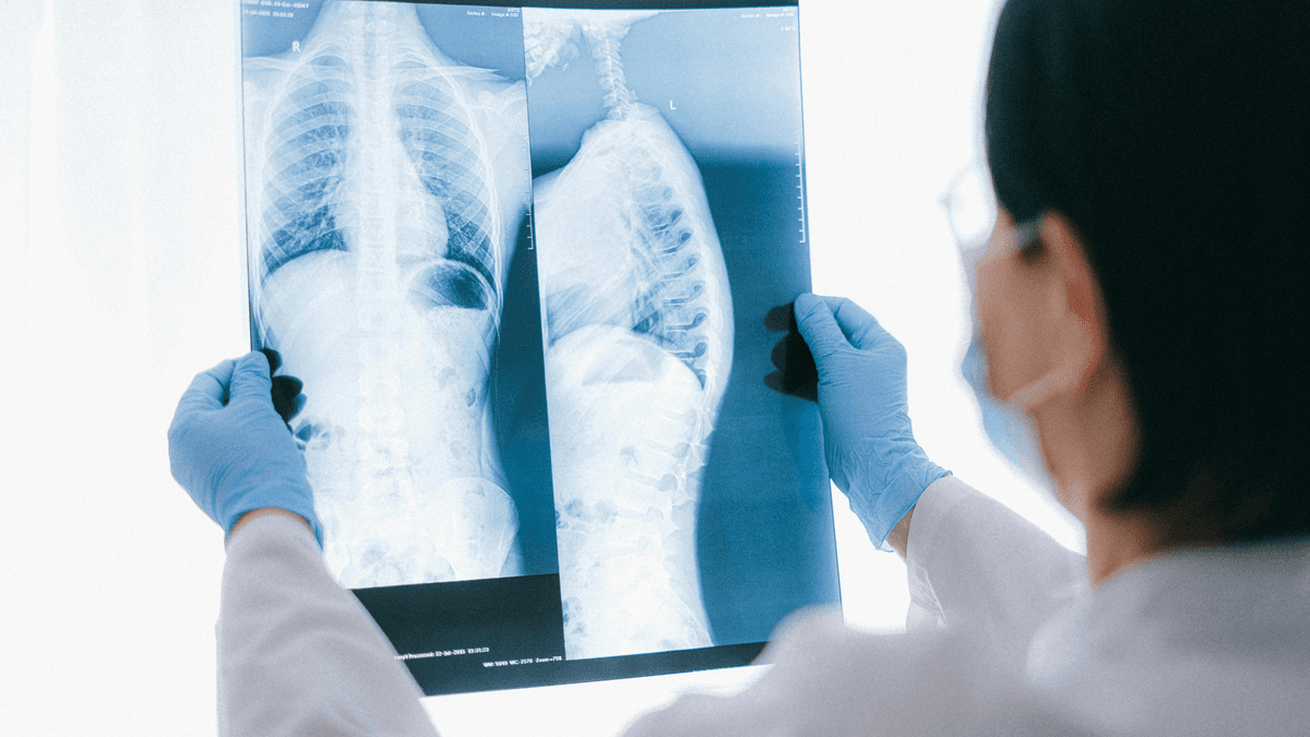 What Are X-Ray Tests and How Do They Work?